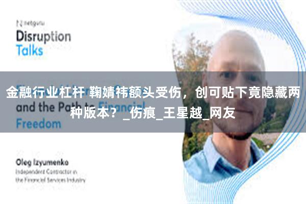 金融行业杠杆 鞠婧祎额头受伤，创可贴下竟隐藏两种版本？_伤痕_王星越_网友